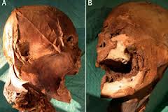 El ADN confirma la autenticidad de la cabeza momificada de Enrique IV