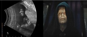 La ecografía de un bebé se parece a la cara del emperador de La Guerra de las Galaxias