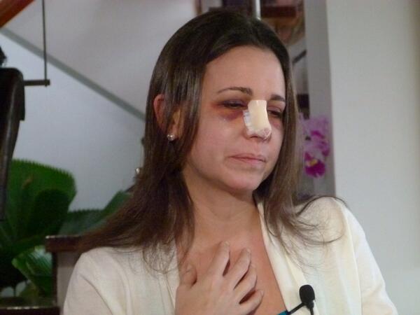 Así se ve María Corina Machado luego de su operación (Foto)