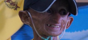 Fallece el primer paciente Wayuu con envejecimiento prematuro