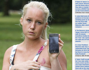Una joven sufre quemaduras al incendiarse su iPhone mientras lo cargaba