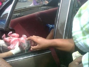Una bebé zuliana nació dentro de un carro frente a la maternidad (Foto)