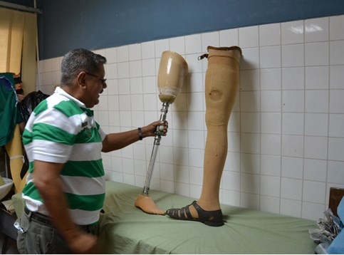 Prótesis de rodilla y cadera son inaccesibles por los elevados precios