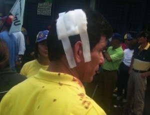 Colectivos apoyados por concejal del Psuv arremetieron contra mitin de Capriles en Bolívar (FOTOS)
