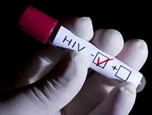 Advierten sobre incremento de casos de VIH en indígenas waraos