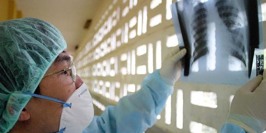 Personal médico expuesto a rayos X tiene más riesgo de cáncer, según estudio