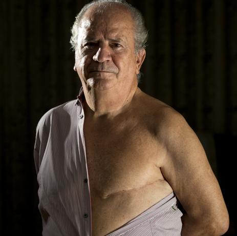 Ernesto Herrero, tenía 61 años cuando un día notó en la ducha cómo su pezón izquierdo se había retraído hacia dentro. E diagnóstico no se hizo esperar: cáncer de mama - Foto: José Ladra