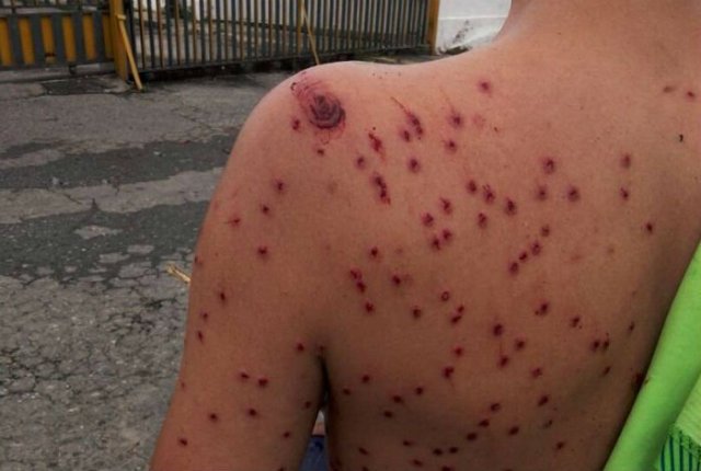 Joven herido durante las protestas de este lunes en Palavecino estado Lara / Foto: otos: @carlosi_suarez