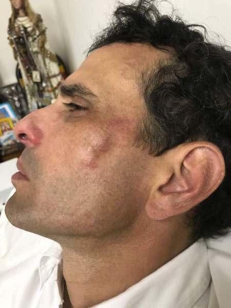 El gobernador del estado Miranda, Henrique Capriles, fue golpeado por la GNB (Foto: @joseolivaresm)
