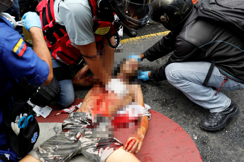 Una bomba lacrimógena presuntamente le habría causado la muerte a un joven en la avenida Libertador
