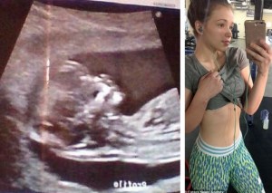 Futura madre es tan delgada que la acusan de fingir sus seis meses de embarazo (fotos)