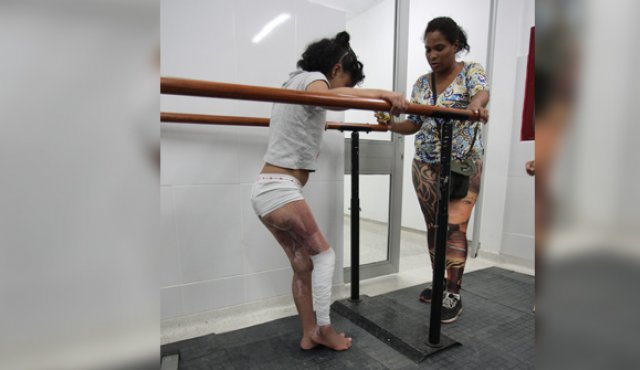 “Me devolvieron la pierna y la vida”, la conmovedora historia de una niña venezolana en Cúcuta