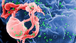 Mujer de California podría ser la primera en curarse de VIH sin medicamentos