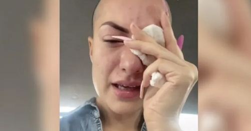 El dramático relato de una joven que confundió gotas para los ojos con pegamento (Video)