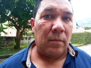 Militares y chavistas golpearon a representante de la MUD en Mérida por denunciar irregularidades