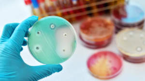 Las bacterias resistentes a los antibióticos ya causan más muertes que el VIH o la malaria