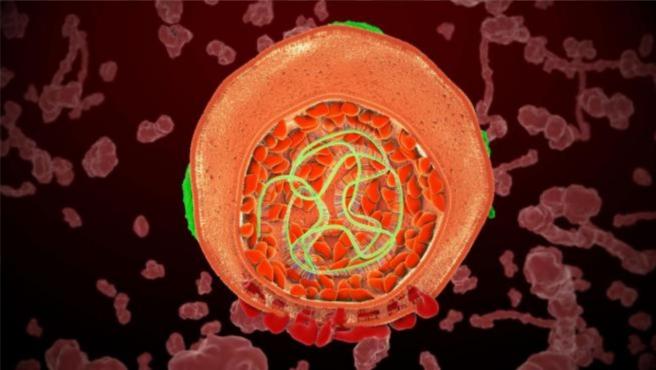 Síntomas de la hepatitis aguda de origen desconocido: causas y prevención de la enfermedad