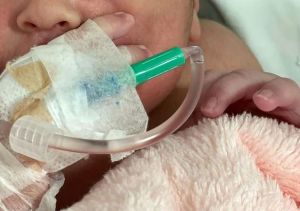 Grave incidente en Brasil: recién nacida recibió 11 puntos de sutura en la cabeza tras caer en el parto