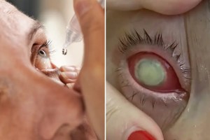 Advierten en EEUU por gotas para los ojos: provocó la muerte de una persona y ocho más perdieron la vista