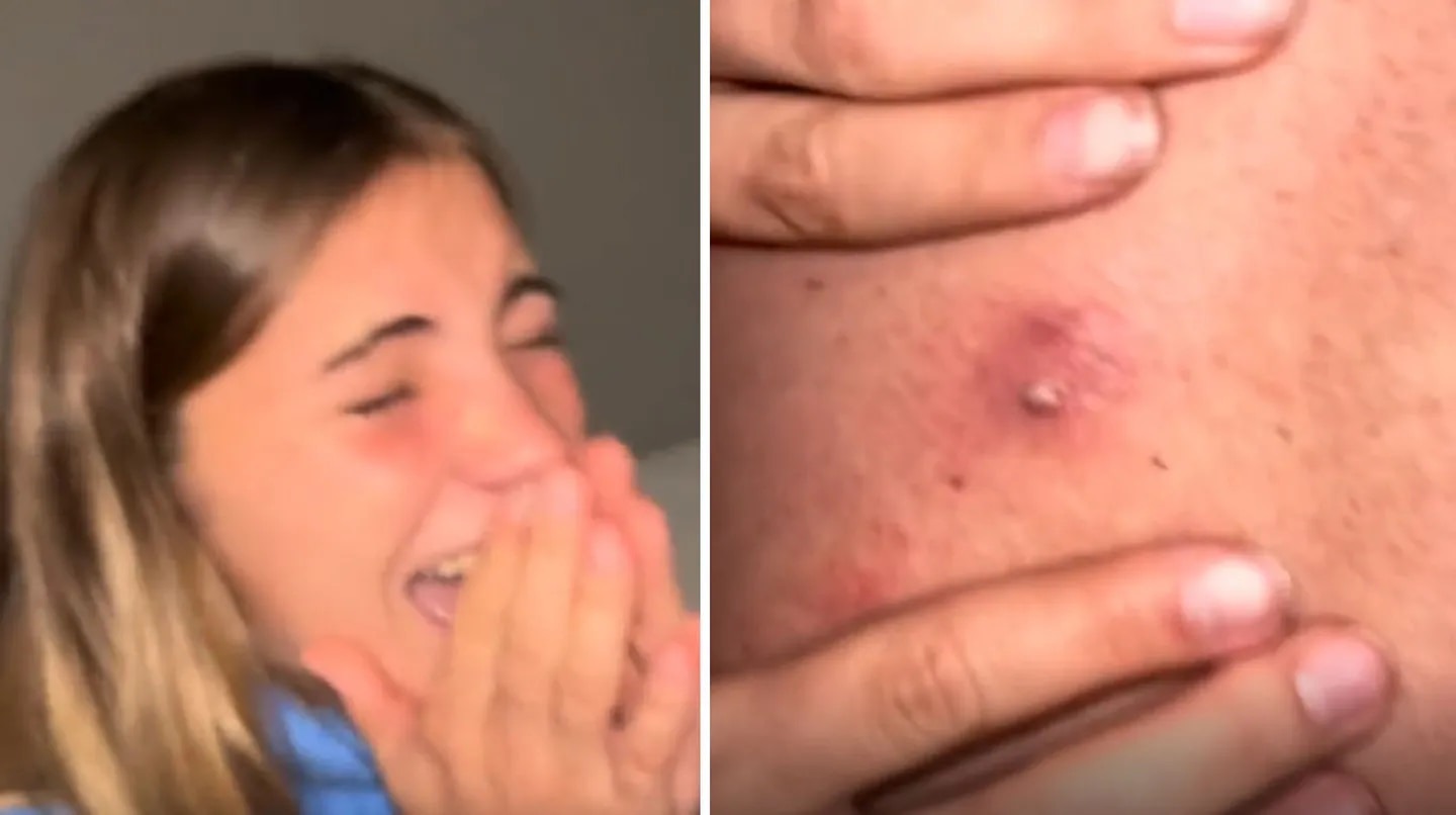 VIRAL: Una joven le explotó un punto negro a su papá y todo terminó muy mal (VIDEO)