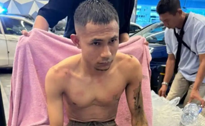 Futbolista rociado con ácido en Malasia “responde bien” a injerto de piel